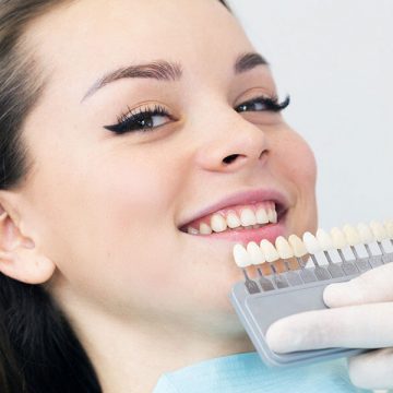 The 4 Types of Dental Veneers Explained