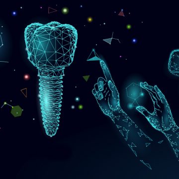 Dental Implants and How They Affect Your Speech