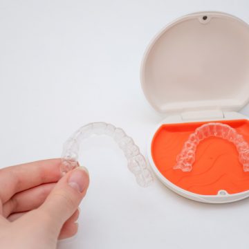 9 Reasons Why Invisalign is a Better Option Than Traditional Braces