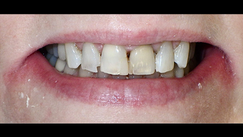 Before image