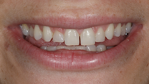 Before image