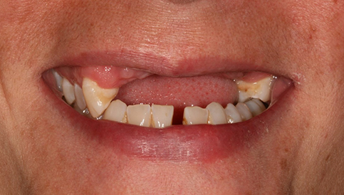 Before image