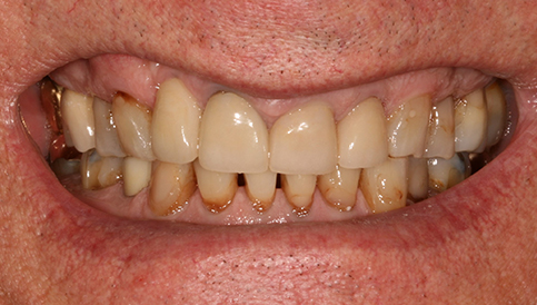 Before image
