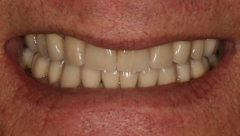 After image
