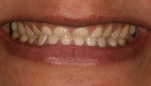 Before image