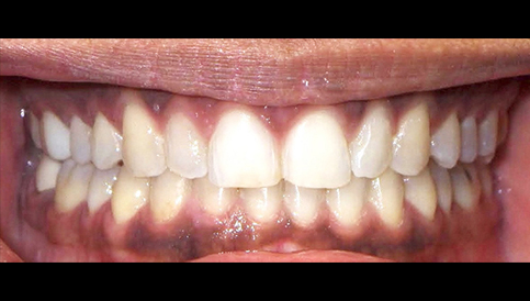 After image