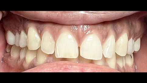 Before image