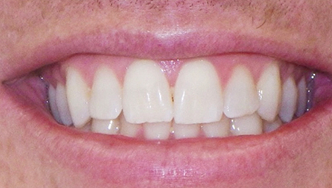 Before image