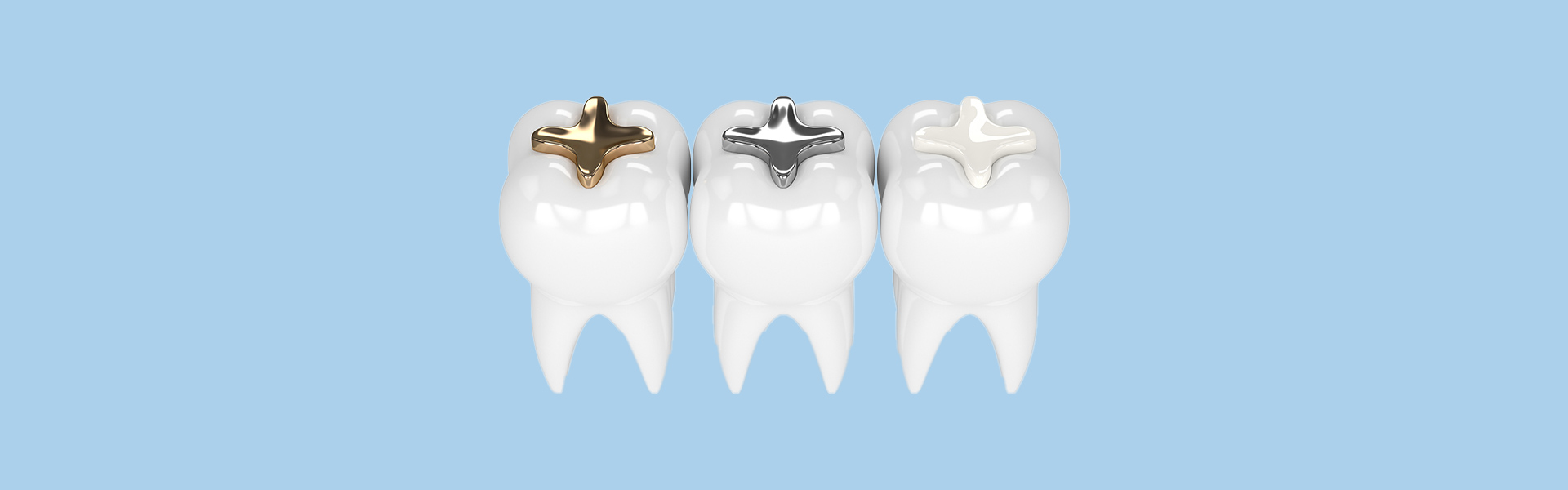 Benefits of Choosing Tooth-Colored Fillings Over Metal Fillings